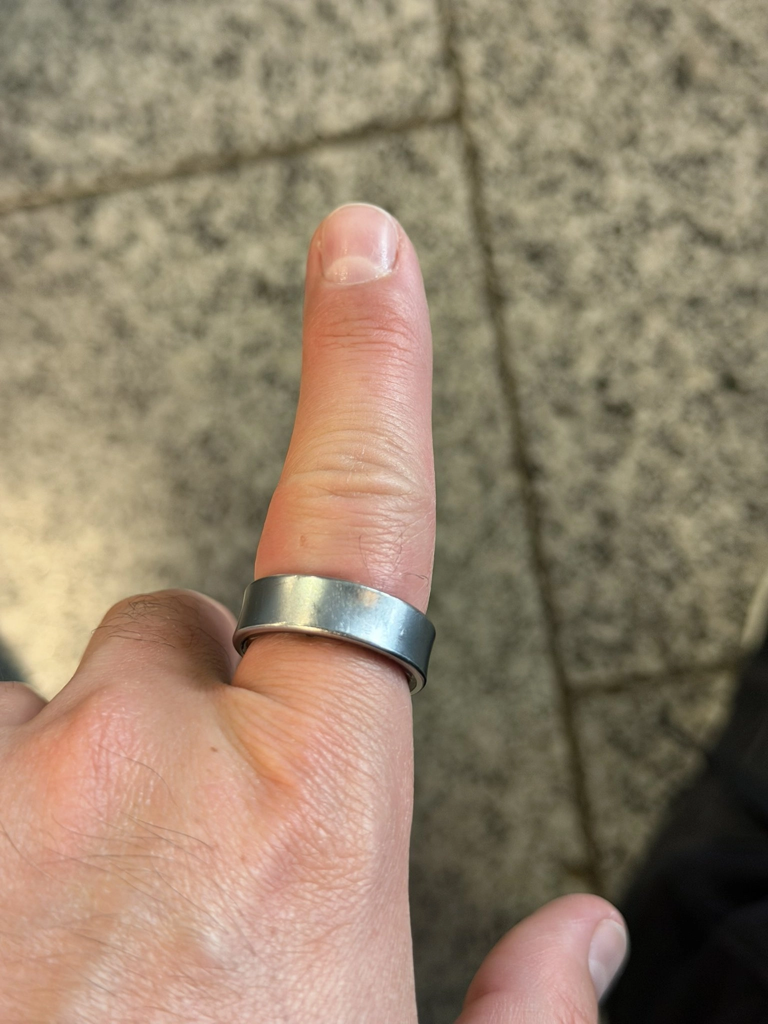 Samsung Galaxy Ring tehlike yarattı - Şişen batarya hastanelik etti